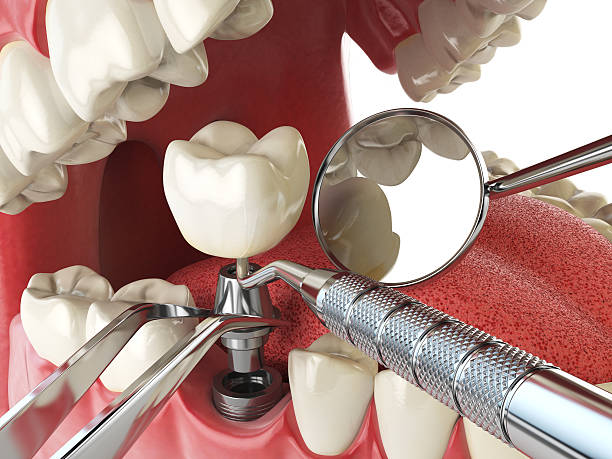 Best Emergency Dental Surgery in Port Washington, NY